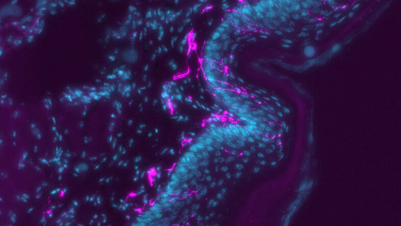 Nervenfasern (pink) durchziehen die oberste Schicht einer Hautprobe (blau). Spezielle Proteine in der Probe sind mit fluoreszierenden Stoffen markiert, wodurch im Mikroskop ein Bild entsteht.