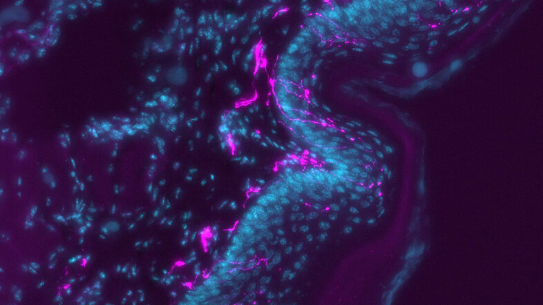 Nervenfasern (pink) durchziehen die oberste Schicht einer Hautprobe (blau). Spezielle Proteine in der Probe sind mit fluoreszierenden Stoffen markiert, wodurch im Mikroskop ein Bild entsteht.