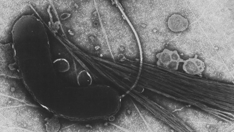 Ein transmissionselektronenmikroskopisches Bild: Ein wurstförmiges Objekt mit einem Schwanz vor dem Hintergrund einiger Flecken und Linien.