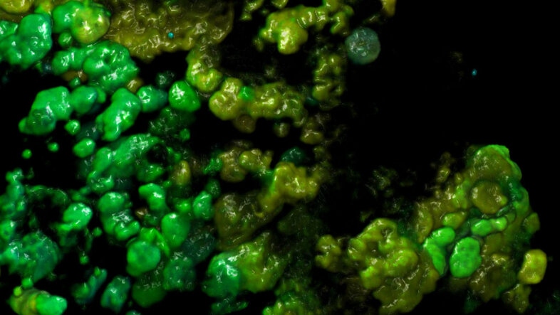 3D-Rekonstruktion der Mikrokolonien von Ammoniak-Oxidierern (gelb) und Nitrit-Oxidierern (grün) in Biofilm aus einer Kläranlage.