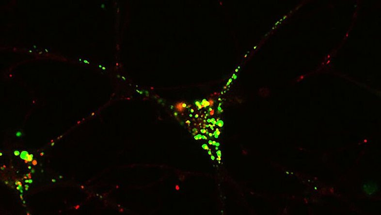 © Rot und grün leuchtende Punkte in einer Nervenzelle