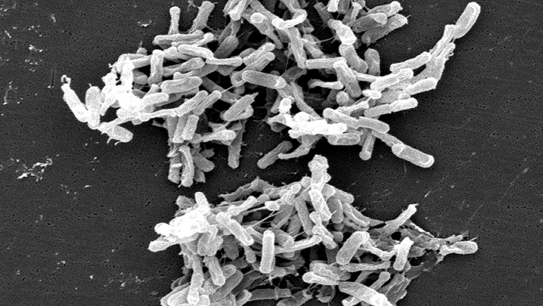 A scanning electron microscope image: several sausage-shaped objects in two larger clumps