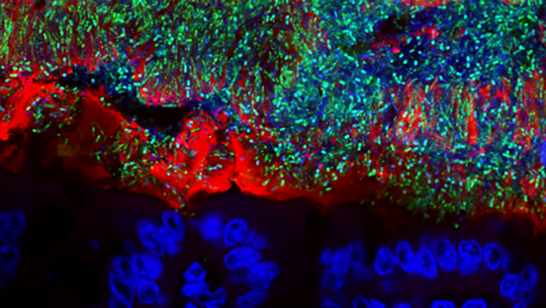 Ein Fluoreszenz-Mikroskop-Bild: Unten einige größere, rundliche, blaue Objekte (menschliche Zellen), oben eine Vielzahl kleiner, länglicher grüner Objekte (Bakterien), dazwischen ein rotes Band (Schleimschicht), das teilweise mit Bakterien durchsetzt ist.