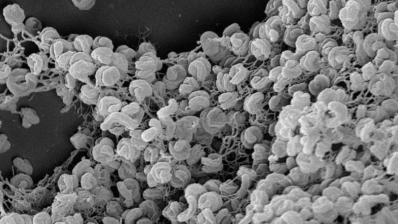 Elektronenmikroskopische Aufnahme eines Zell-Aggregats von Comammox-Bakterien der Art Nitrospira inopinata